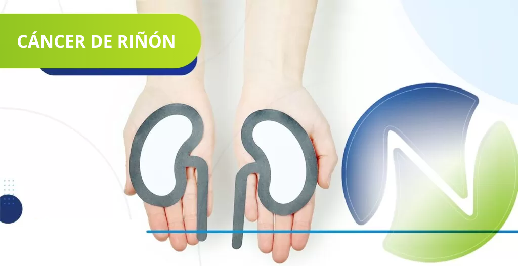 C&aacute;ncer de ri&ntilde;&oacute;n conozca m&aacute;s sobre la enfermedad